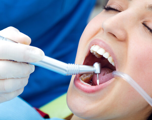 Fillings & gum treatment