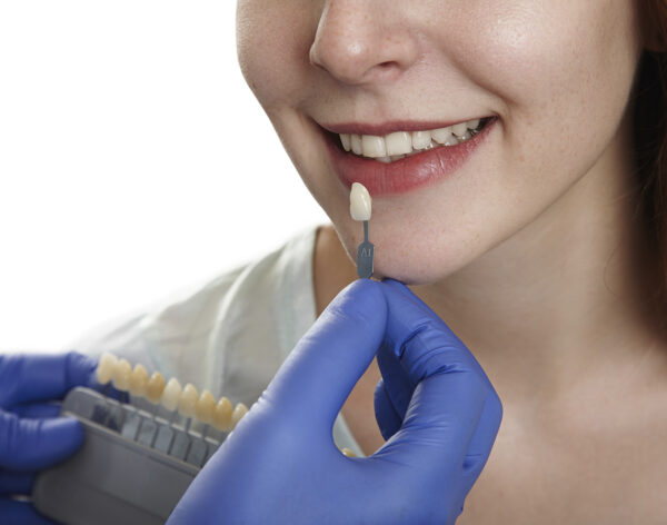 Veneers & composite bonding