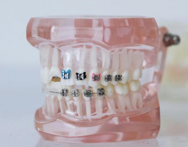 Partial & Complete dentures