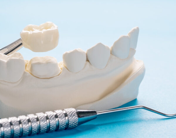Closeup / Prosthodontics or Prosthetic / Single teeth crown and bridge equipment model express fix restoration.